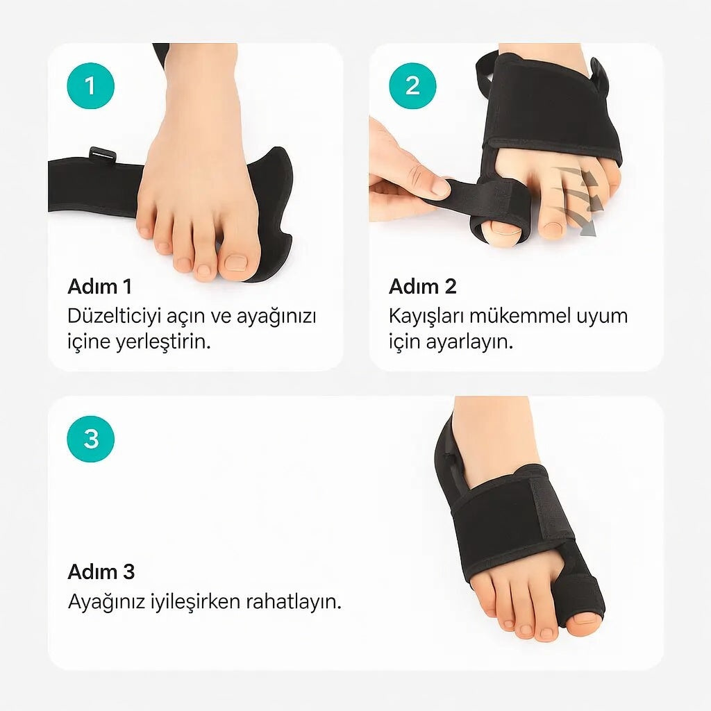 Pedigrip Ayak Baş Parmak Bunyon Koruyucu